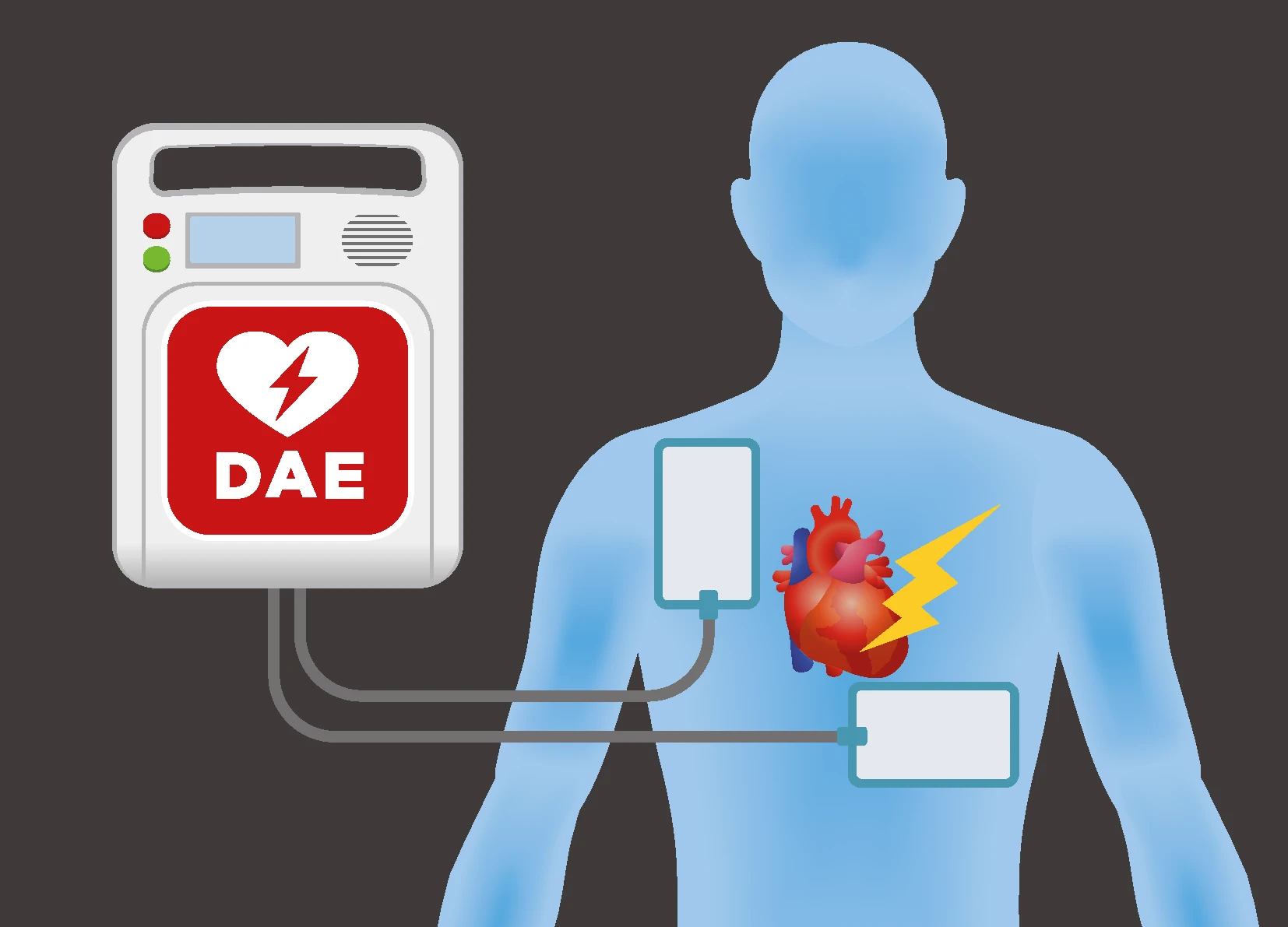 SIV in Missione: Azienda Cardioprotetta